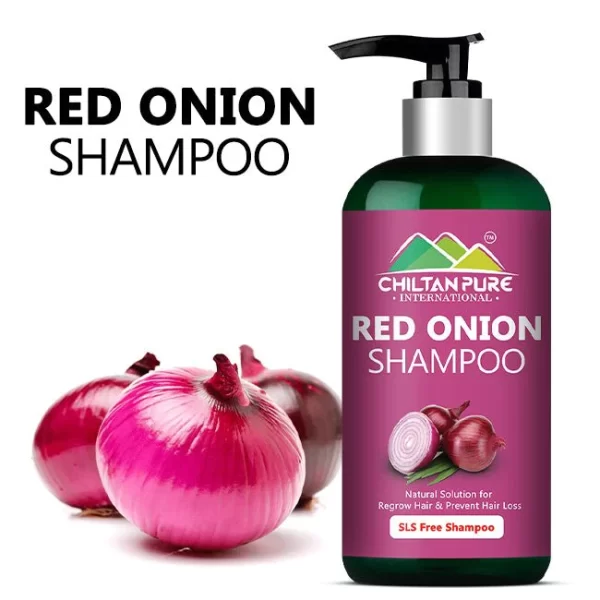 https://www.shecosmetics.pk/wp-content/uploads/2023/10/Onion-Shampoo.webp